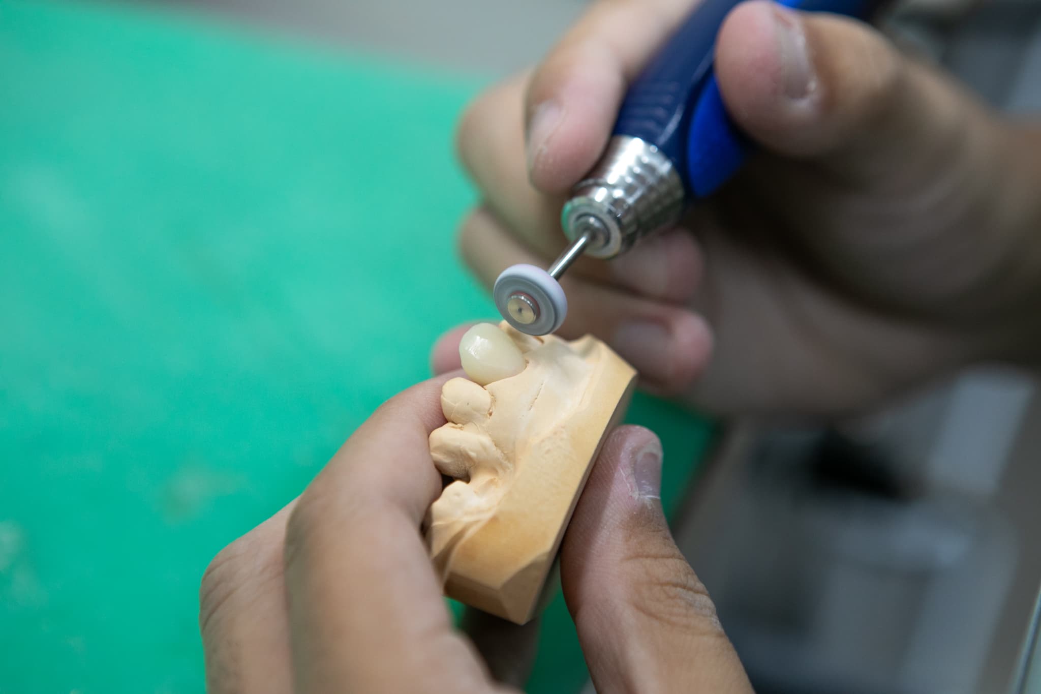 歯の模型の接着具合の確認