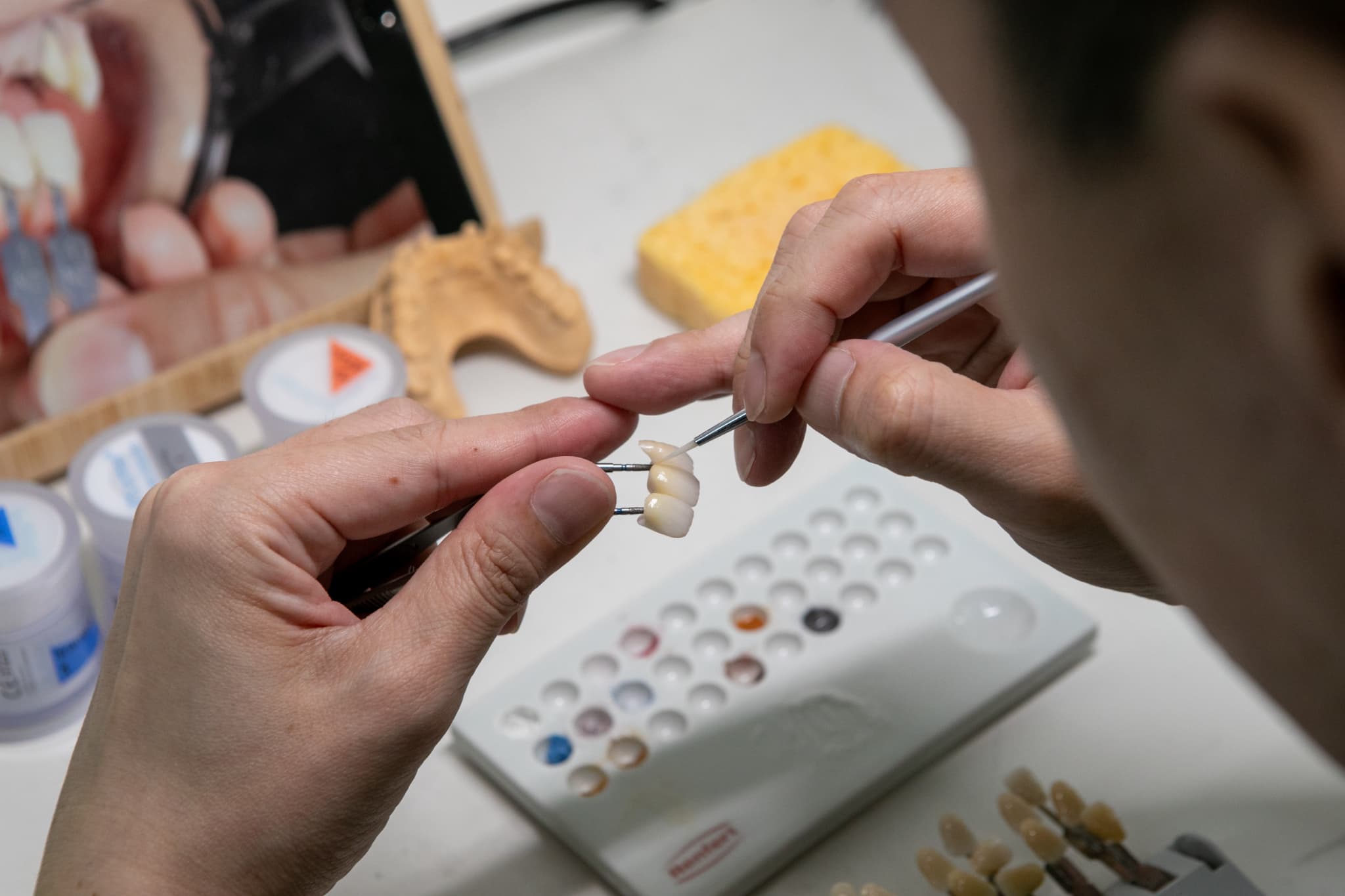 歯の模型に着色している技師