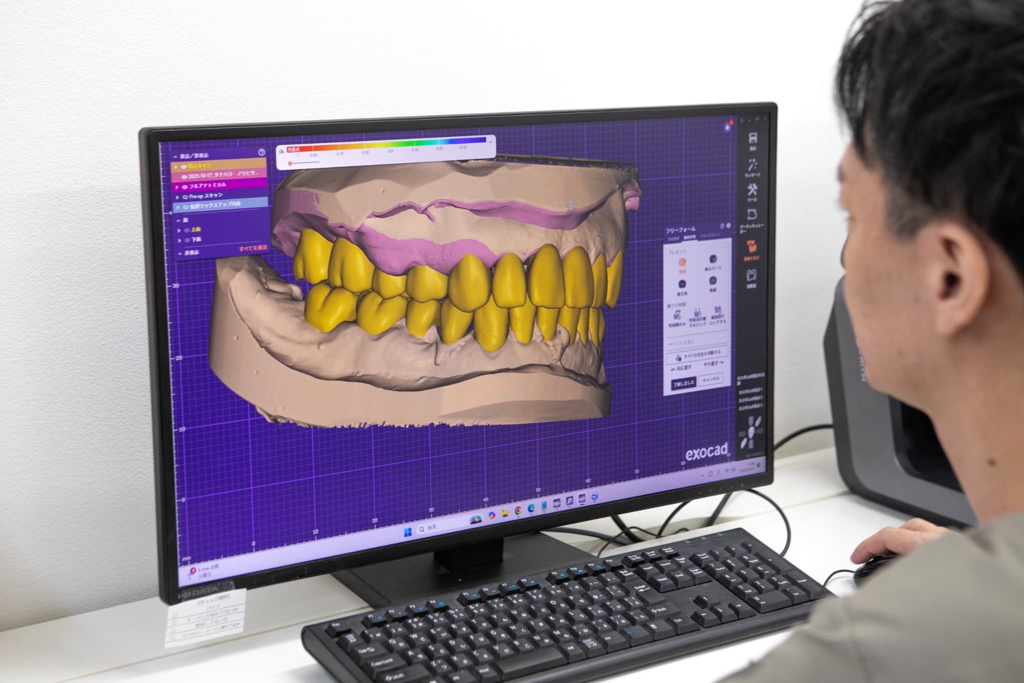 先の細い機械で仕上げをする歯科技工士