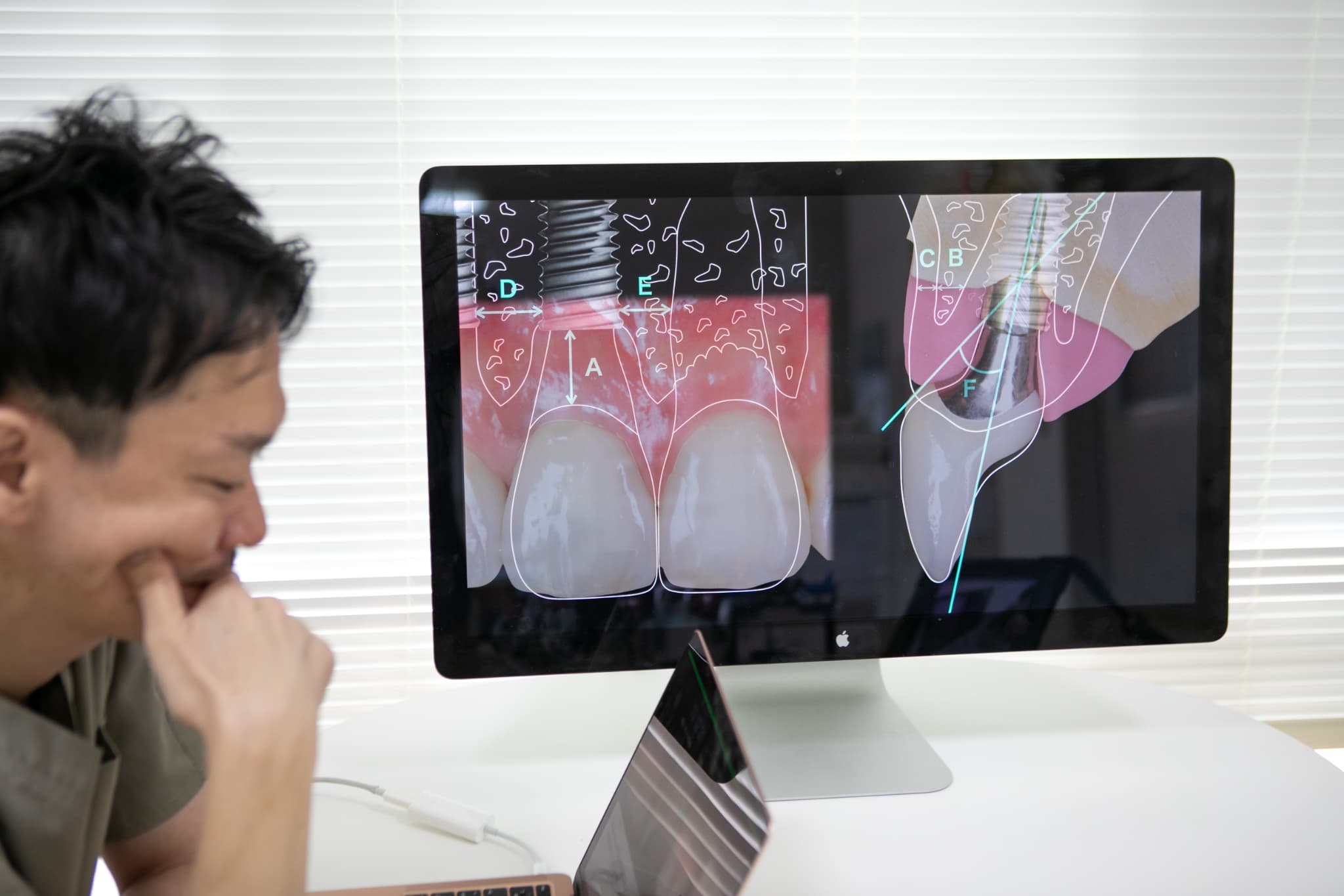 口腔内スキャナーデータ受入システム